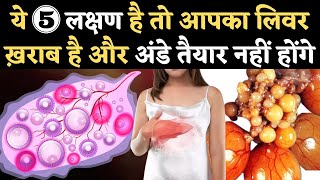 ये 5 लक्षण है तो आपका लिवर ख़राब है और अंडे तैयार नहीं होंगे  Liver Problem and Fertility in Hindi [upl. by Eitac]