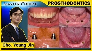 Master Course Season2 PROSTHODONTICS Solitary type Overdenture [upl. by Belloir174]