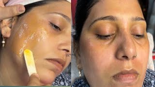 Full face wax by white chocolate wax facial hair kaise htayewaxing skincare waxingtips facewax [upl. by Vlada]