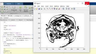 Matlab Dicom 3d [upl. by Faline]