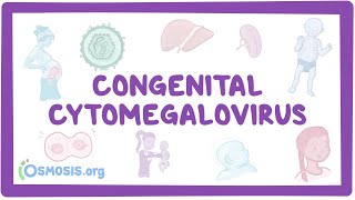 Congenital CMV  causes symptoms diagnosis treatment pathology [upl. by Ashleigh]