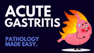 Acute Gastritis Pathology Simplified MUST KNOW [upl. by Nette352]