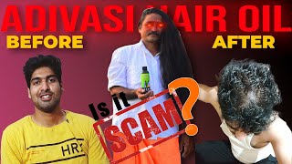 ADIVASI HAIR OIL SCAM  MY PERSONAL EXPERIENCE [upl. by Garlaand]