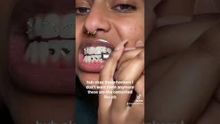 REMOVING MY TOOTH GEMS ATHOME toothgems toothgemremoval athometoothgemremoval whiteteeth asmr [upl. by Gut]