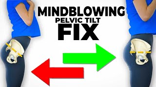 The Mindblowing Best Fix For Anterior Pelvic Tilt instant results [upl. by Pul]