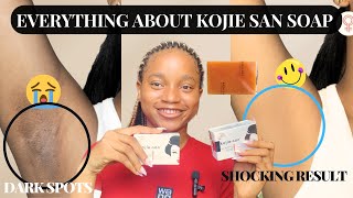 HOW TO EFFECTIVELY USE KOJIE SAN SOAP  Kojie San Soap Detailed Review [upl. by Magas44]