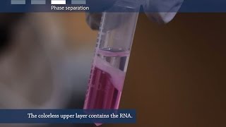 How to isolate RNA from tissue or cells [upl. by Pascasia837]