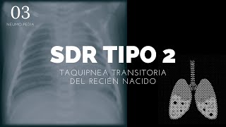 Taquipnea transitoria del recién nacido  ENARM [upl. by Jain243]