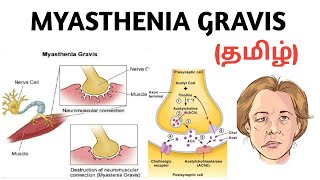 Edrophonium Pharmacology  CHOLINERGIC DRUGS  Myasthenia Gravis Clinical Uses [upl. by Shushan]