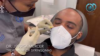 Treatment of Syringomas with Dr Jessica Mercer [upl. by Nivat]