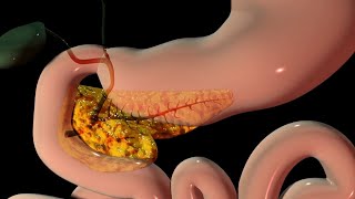 Pancreas Explained  3D Animation [upl. by Eirehs]