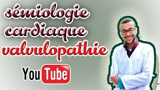 sémiologie cardiaque valvulopathie gauche [upl. by Ahsikrats]