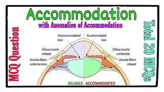 MCQ  Accommodation and its Anomalies [upl. by Berty]