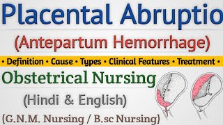 Placental Abruptio In Hindi  Abruptio Placenta क्या होता है  Antepartum Hemorrhage Lecture [upl. by Voleta299]