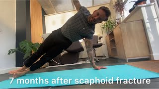 7 months after scaphoid fracture recovery update exercises progress [upl. by Jacquie]