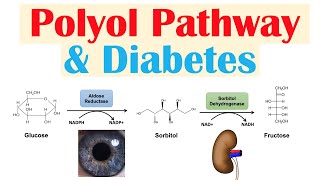 Polyol Pathway amp Diabetes  The Role of Polyol Pathway in Diabetes Pathogenesis [upl. by Asia252]