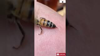 Bee sting 🐝ShortsVideo [upl. by Adehsar325]