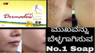 Dermadew Liite Soap Review In KannadaSkin whiteningRemove PigmentationGlowing skin [upl. by Esilegna82]