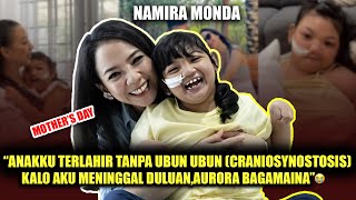 NAMIRA MONDA quotANAKKU TERLAHIR TANPA UBUN UBUN CRANIOSYNOSTOSIS🥹” [upl. by Ethelstan]