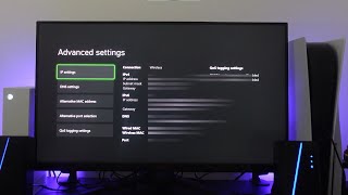 How To Fix Xbox Series XS WiFi Connection Issues [upl. by Hearn]