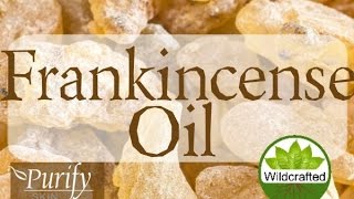 Frankincense Essential Oil  All You Need To Know [upl. by Recneps]