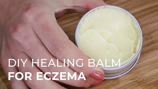 Tutorial for making a Natural Healing Cream for Eczema and Psoriasis [upl. by Rudin]