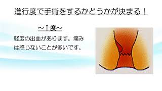 痔核（いぼ痔）の進行度【ららぽーと横浜クリニック】 [upl. by Ezarra]