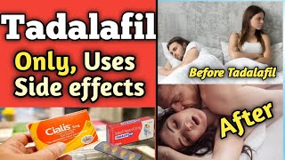 Tadalafil  Tadalafil 20mg Tablet Uses in Hindi [upl. by Laurentia158]