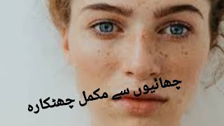 Freckle treatmentpigmentation permanent curechayun is ilaj [upl. by Mesics]