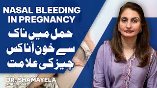 Nasal Bleeding In Pregnancy is it normal How To Stop Bleeding Nose  Shamayela Hanif  Gynecologist [upl. by Imled]