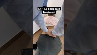 L4  L5 back pain treatment by dr harish grover [upl. by Ylrae]