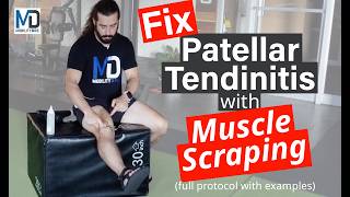 Full Muscle Scraping Protocol for Patellar Tendinitis  Gua Sha Routine [upl. by Aynuat35]