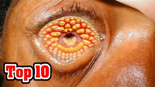 Top 10 Common Phobias You Probably Have [upl. by Ierdna]