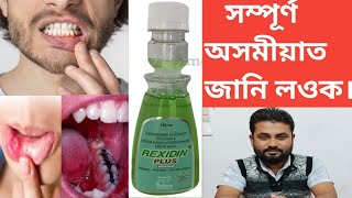 REXIDIN PLUS Mouthwash  Antiseptic  Anticaries Solution [upl. by Ellenej]