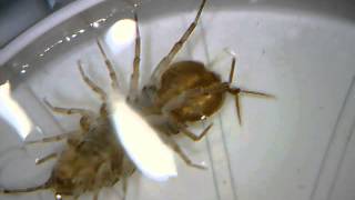 microscope video of asellus aquaticus waterlouse aquatic sowbug  Wasserassel unterm Mikroskop [upl. by Tia]