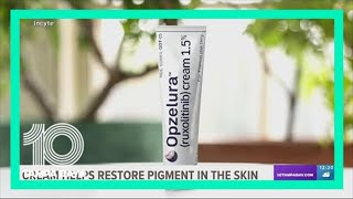 FDA approves cream to help those with vitiligo [upl. by Eniamzaj789]