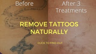 How To Remove Tattoos Naturally [upl. by Alton]