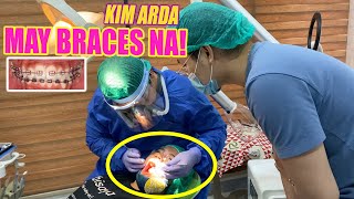 May BRACES na si KIM ARDA [upl. by Nosreg]