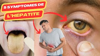 5 symptômes de lhépatite  hépatite virale c  hépatite virale b  hepatite a  hépatite [upl. by Meean]