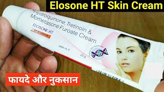 Elosone HT Skin Cream Ke Fayde Or Nuksan  Hydroquinone Tretinoin amp Mometasone Furoate Cream [upl. by Toscano671]