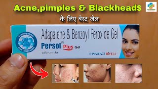 Persol Plus Gel Use in Hindi  Acnepimples Blackhead  Adapalene amp Benzoyl peroxide SK MEDICINE [upl. by Blaine]