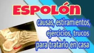 Espolon tratamiento complejo en casa masaje estiramiento trucos para desinflamar y quitar dolor [upl. by Pierrette925]