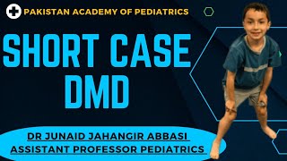 Short Case DMD Duchenne muscular dystrophy ByDrJunaidJahangirAbbasi [upl. by Eislrahc]