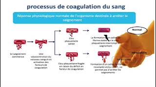 Hemato 10Coagulation  Hémophilie Dr Abbadi [upl. by Jordain]