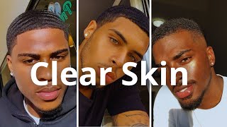 How To Get Clear Skin Naturally [upl. by Wachtel557]