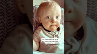 👶A Miracle Baby With Extra 21st Chromosome downsyndrome downsyndromeawareness [upl. by Darrey]