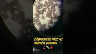 Microscopic view 🔬🦟  🧪💉 microscope malaria medico nursing nursingstudent motivation [upl. by Sibeal]