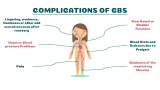 GUILLAINBARRE SYNDROME DIAGNOSIS PROGNOSIS TREATMENT amp COMPLICATIONS  Complications of GBS [upl. by Onirotciv]