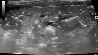 lung ultrasound severe cardiogenic pulmonary oedema in a cat [upl. by Anertac643]