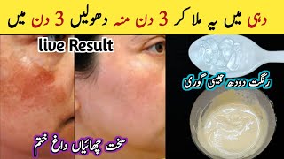 Parmenat Sun Tan Removal within 5 Minute SunbTan Removal Home Remedy  Pigmentation removal at Home [upl. by Kling]